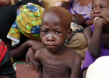 Trump administration announces $5m boost for UNICEF’s malnutrition response in Nigeria