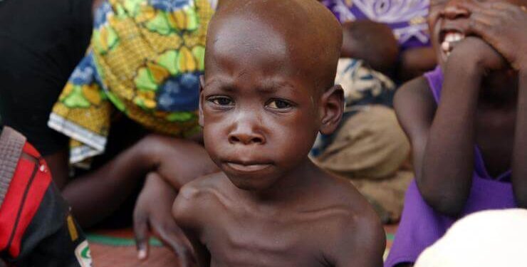 Trump administration announces $5m boost for UNICEF’s malnutrition response in Nigeria