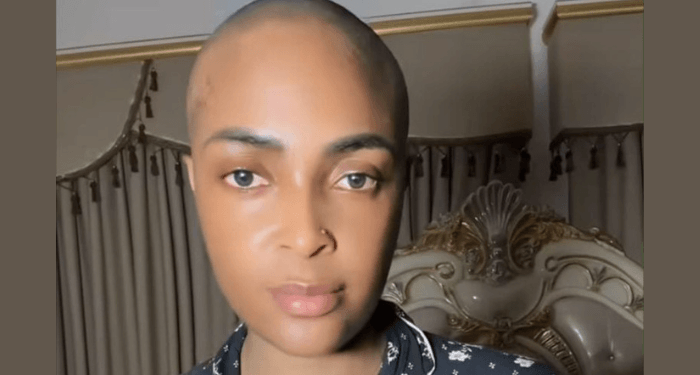 ‘I don’t have stage 4 cancer, it was miscommunication’ – Blessing CEO