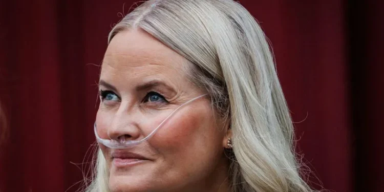 Norway’s crown princess undergoes successful lung transplant